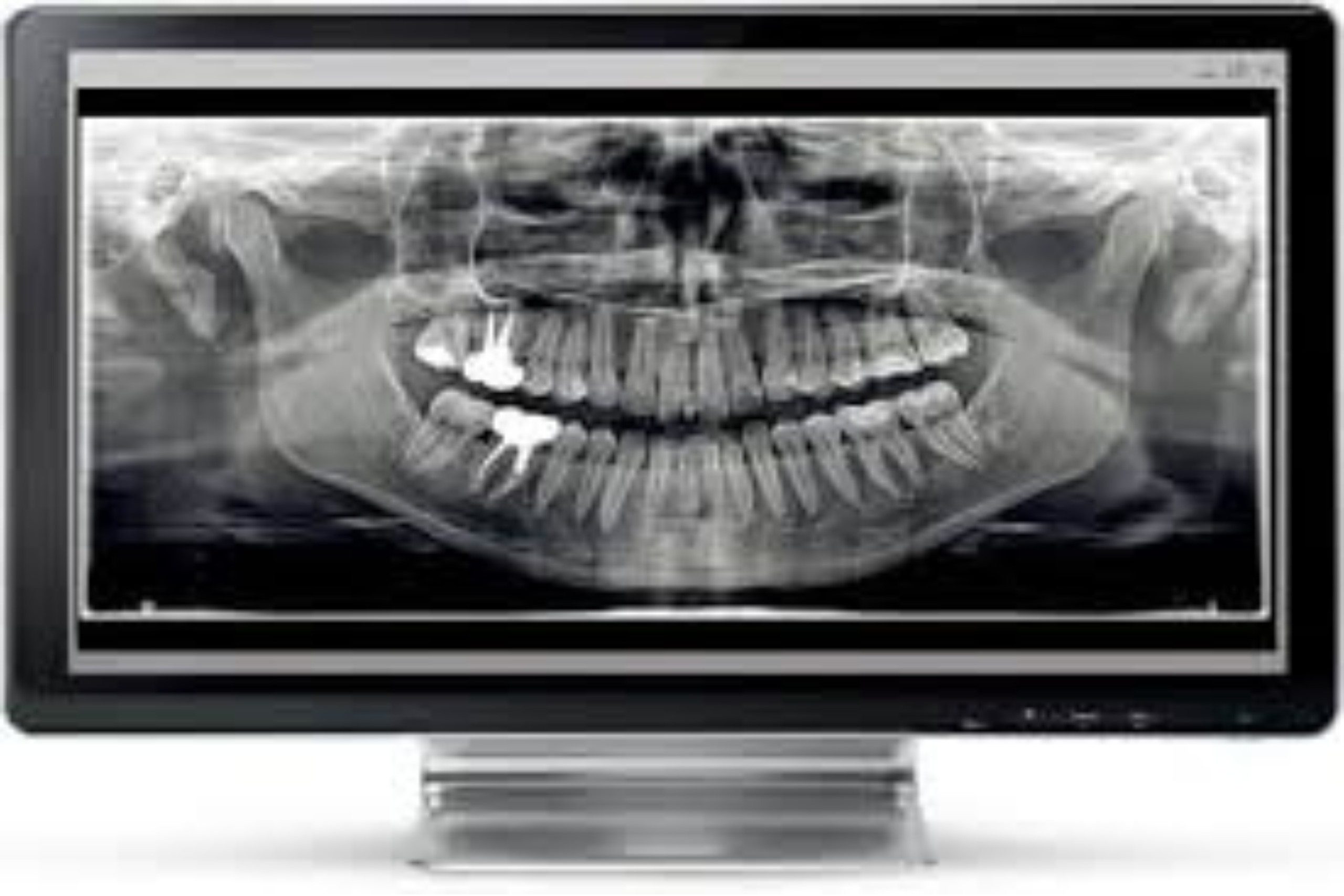 デジタルレントゲンシステム